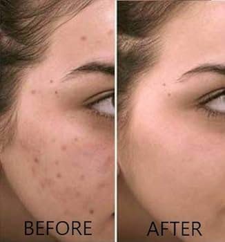 Balea Serum Vitamin C , 30 ml – Image 2